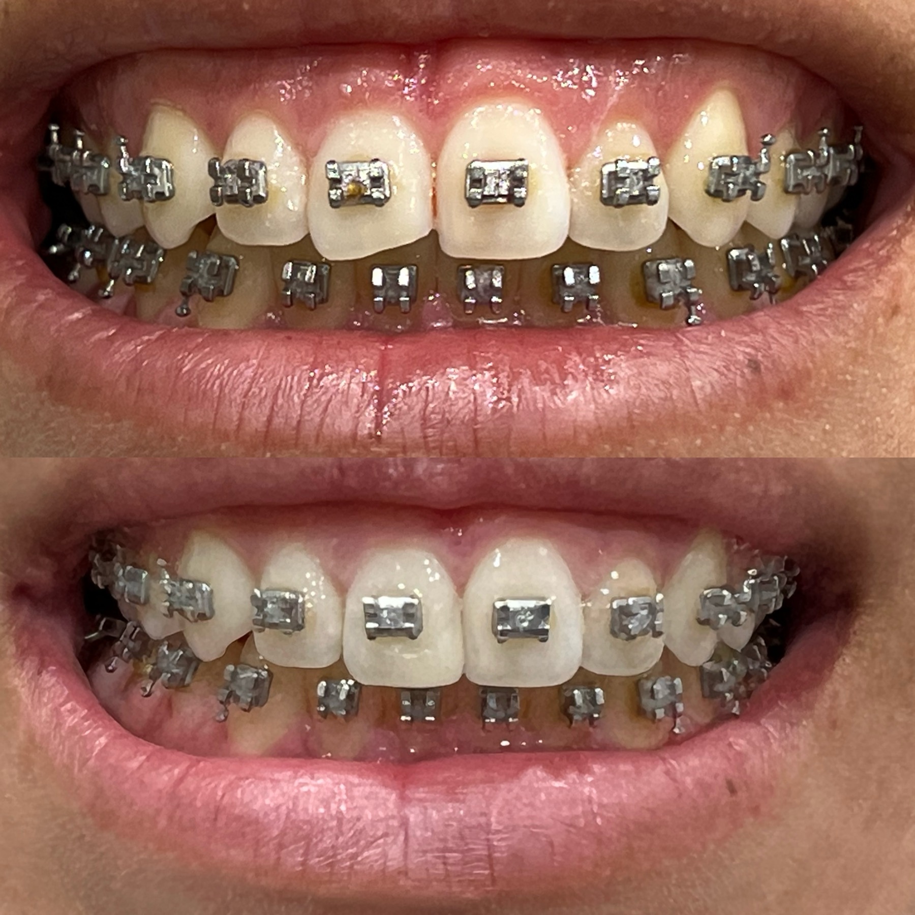 family dentist Fremont