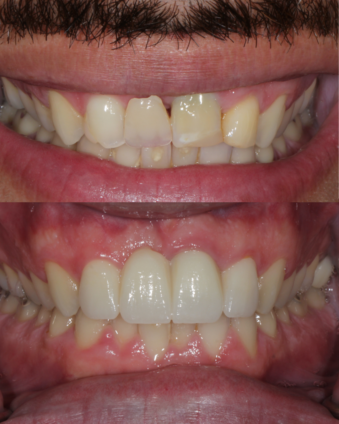 bryant_s star moment.zip - 1