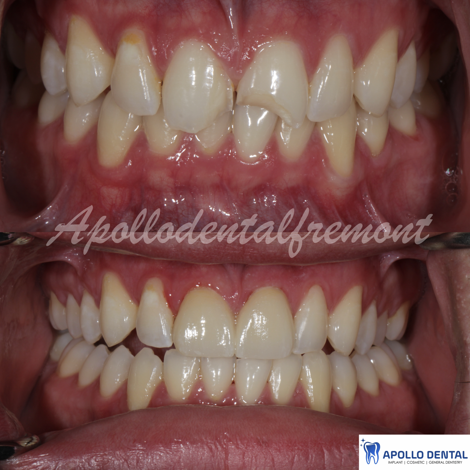 iM PRES practice keynote copy.014