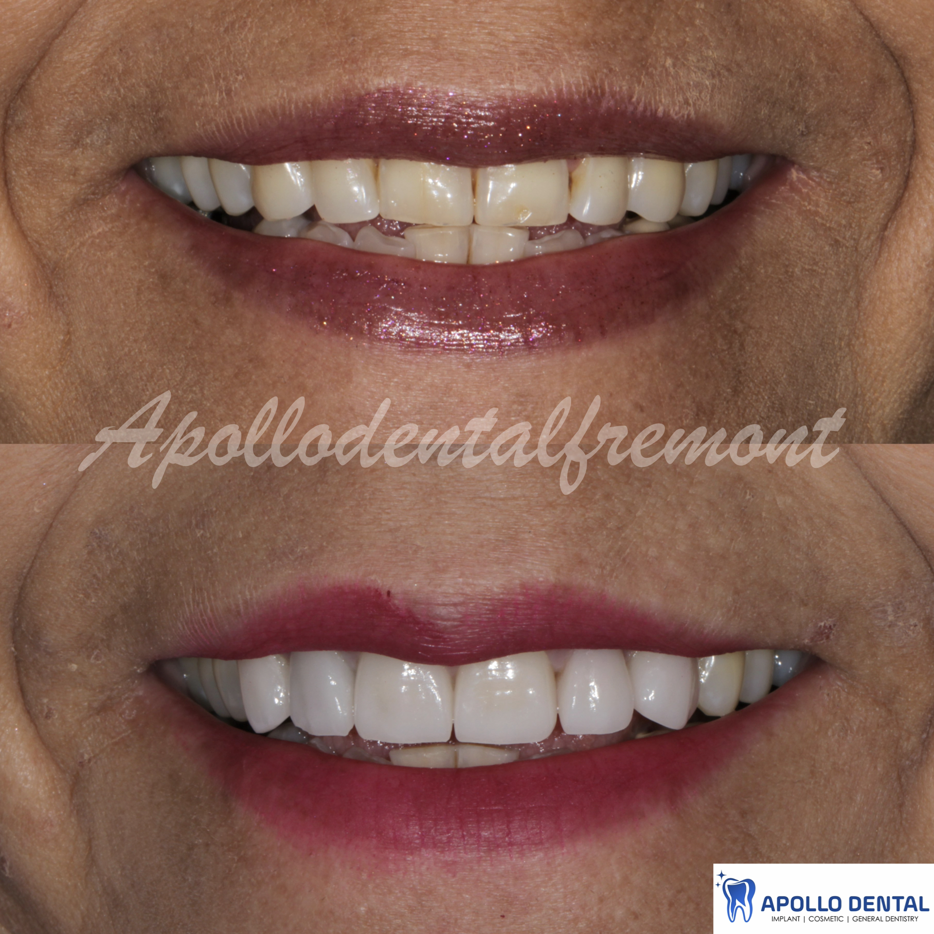 iM PRES practice keynote copy.017