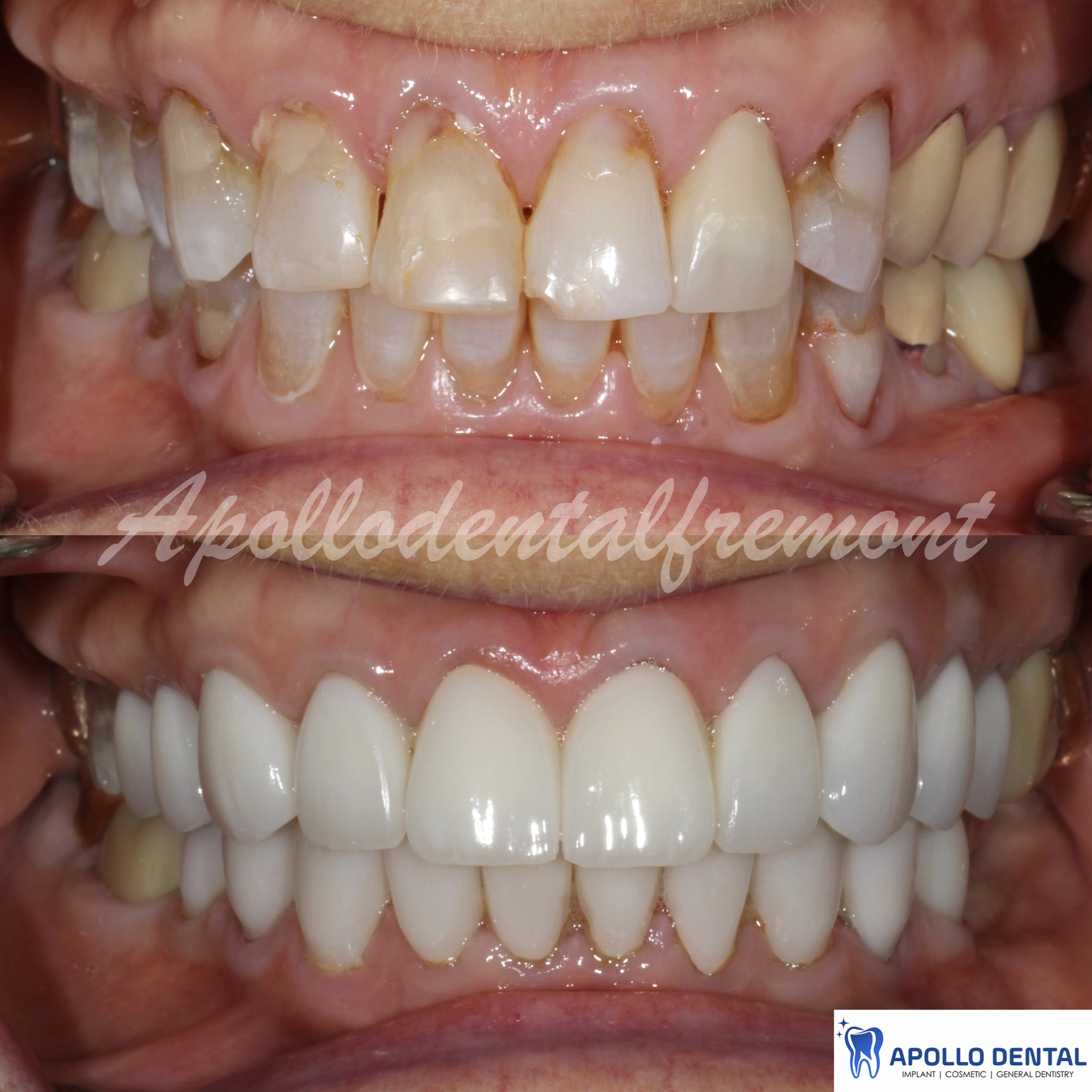 iM PRES practice keynote copy.020