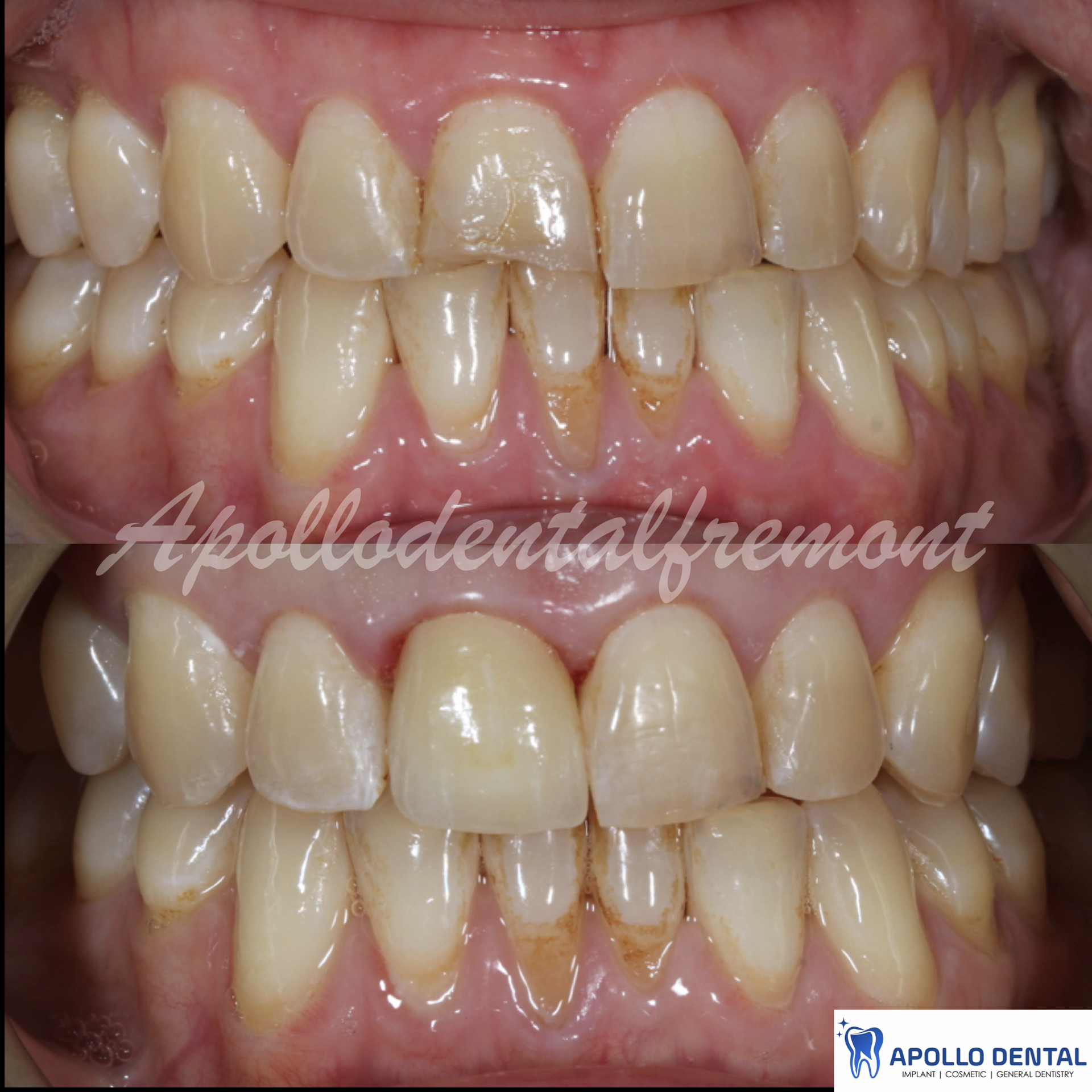 iM PRES practice keynote copy.027