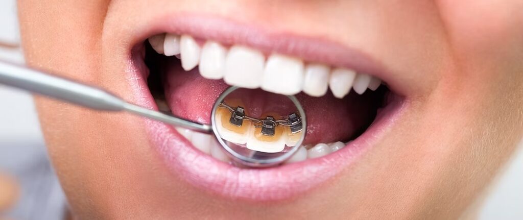 dental emergency Fremont