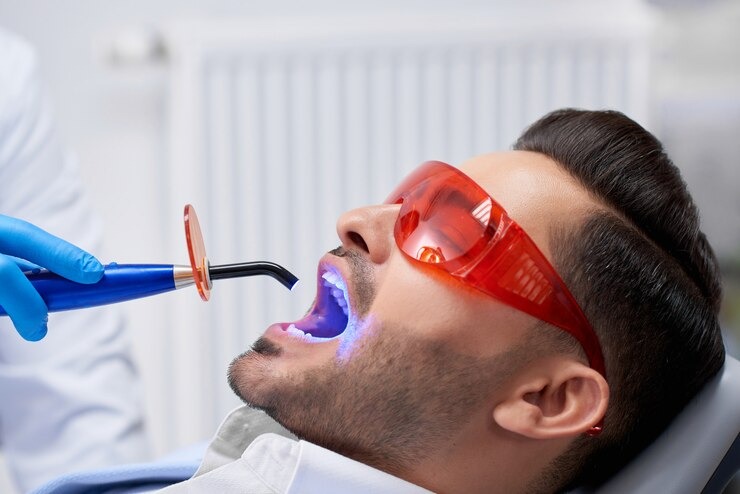 laser teeth whitening
